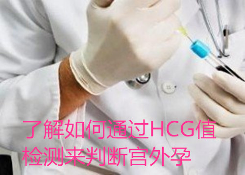 ˽ͨHCGֵжϹ