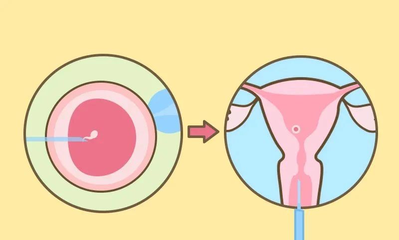 试管助孕期间遭遇“薄内膜”,该如何应对?